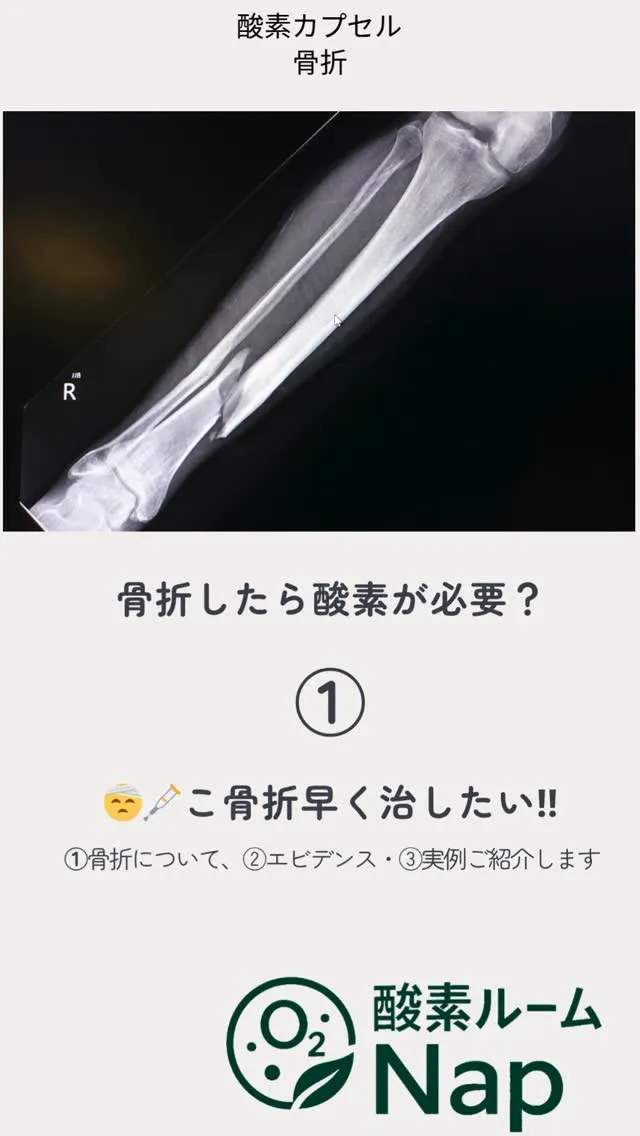 【骨折の回復に酸素が重要？】